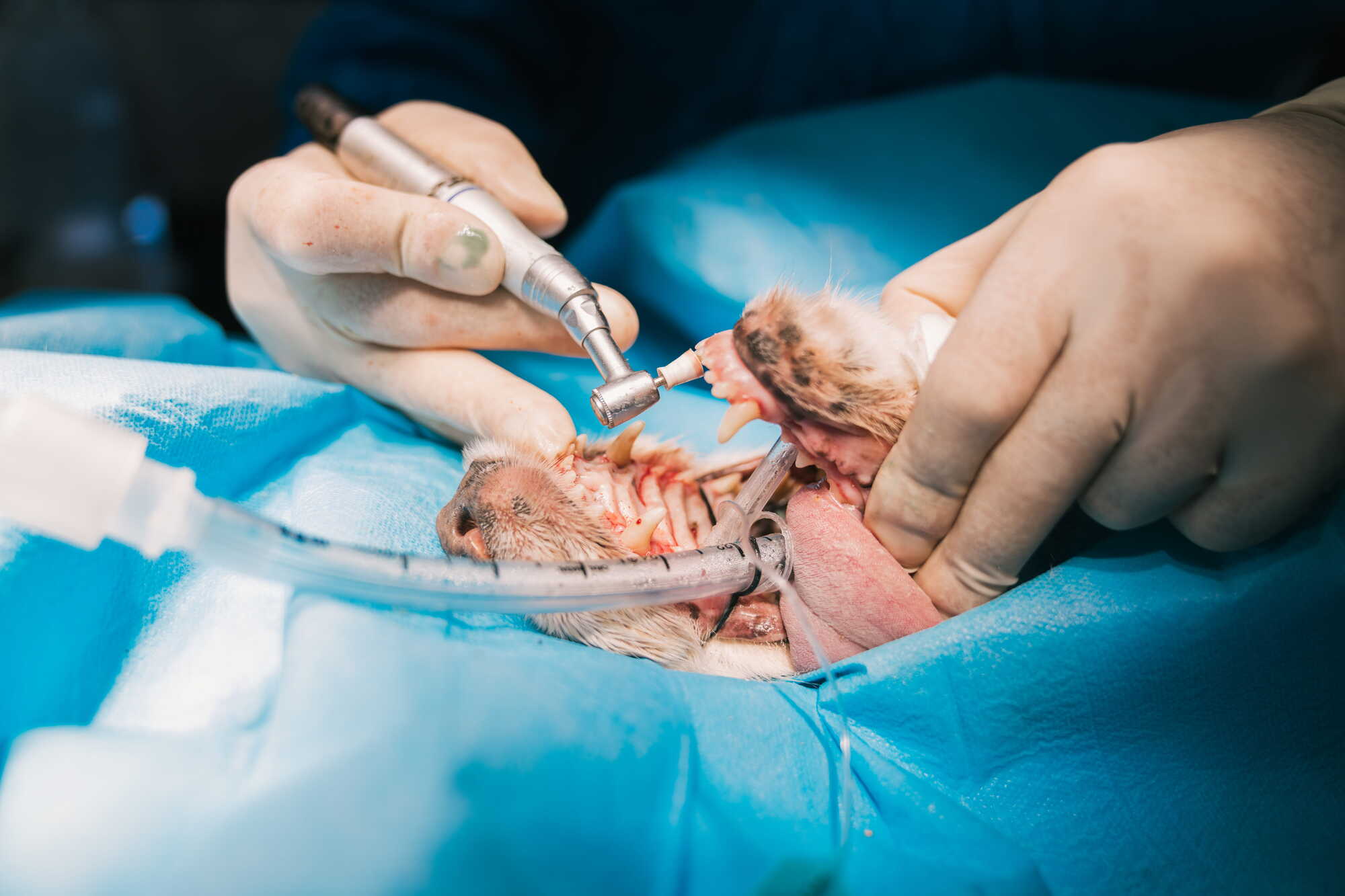 Hoe kies je de juiste dentale boortjes?