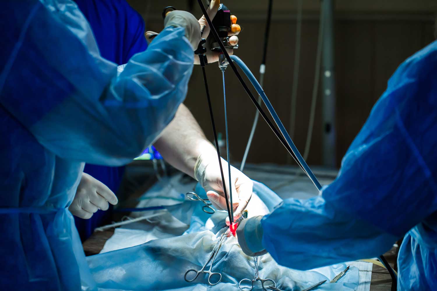 Een laparoscopische ingreep